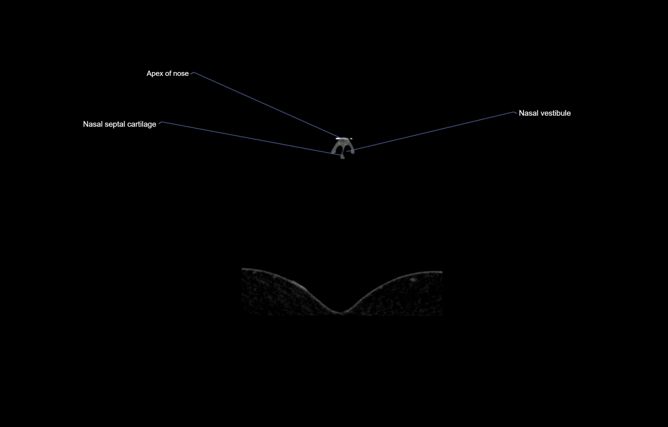 CT Neck coronal  cross sectional anatomy labelled 3D  radiology  image-00002.webp